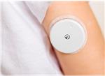 Murata Electronics 连续血糖监测器（CGM）