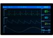 DP-1561-02A & DP-1011-02A Display Modules