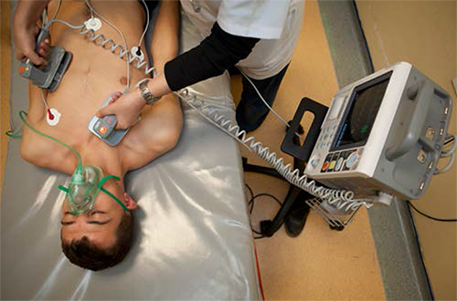 A hospital-style defibrillator with an external electrocardiograph (ECG) or heart monitor on the patient.